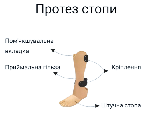 Протез стопи